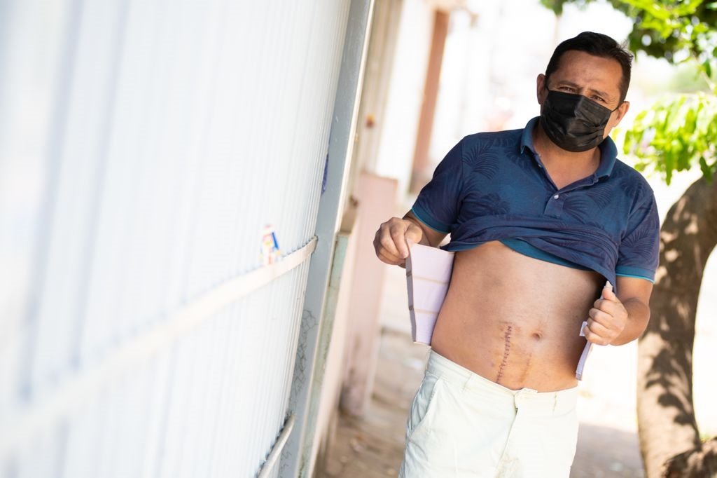 Ivaldo José Vieira, transplantado