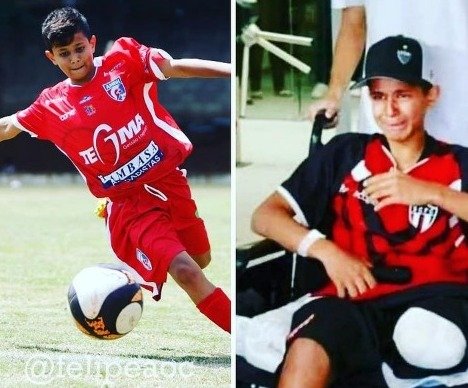 Antes e depois: Gabriel sonhava ser jogador de futebol