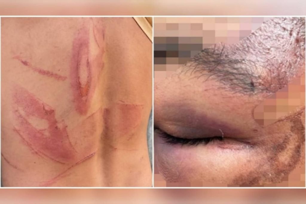 casal de trabalhadores rurais é agredido por fazendeiro e esposa por cerca de 3h em goiás