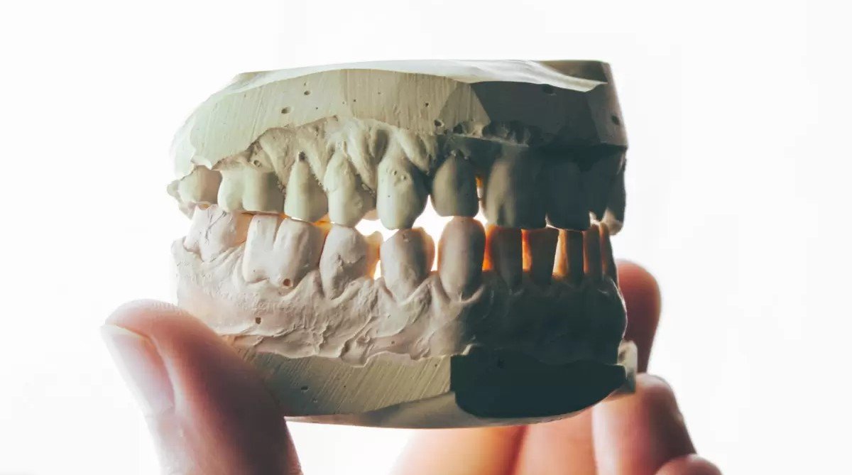 Descoberto motivo dos dentes do siso nascerem apenas na idade adulta