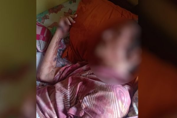 Dois homens são suspeitos de espancar a própria mãe idosa, em Abadiânia, Goiás