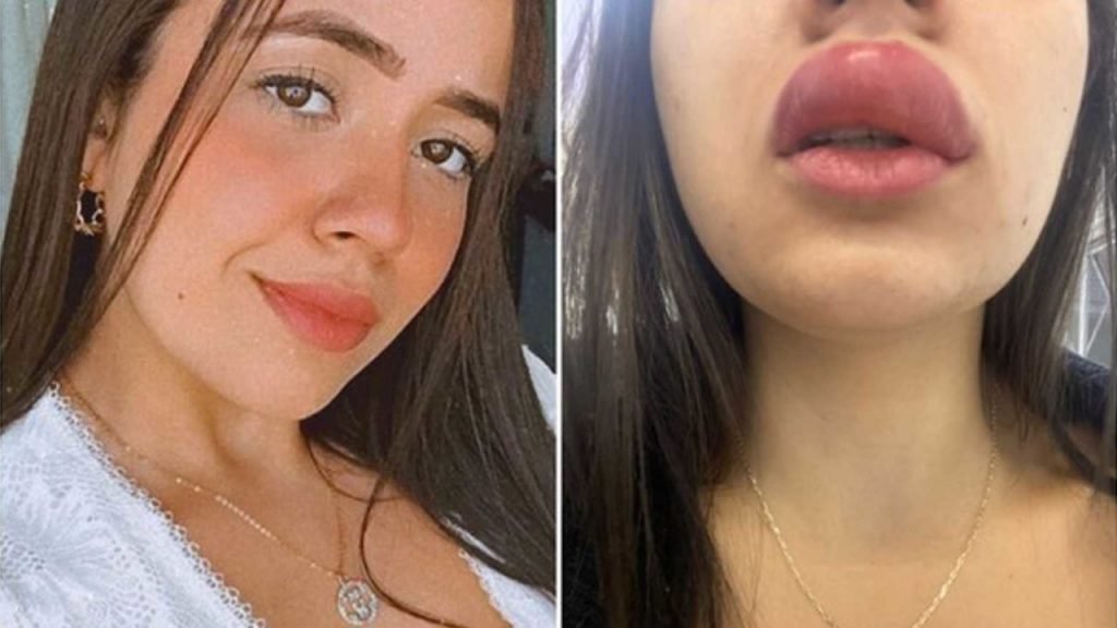 Nataly Galgino foi picada por lacraia e teve reações