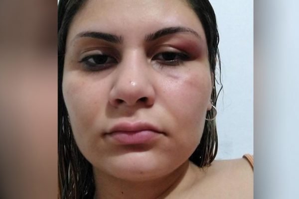 goias mulher denuncia agressao de musico