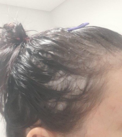 Manuela Menezes apresenta queda de cabelo após ser diagnosticada com a Covid-19