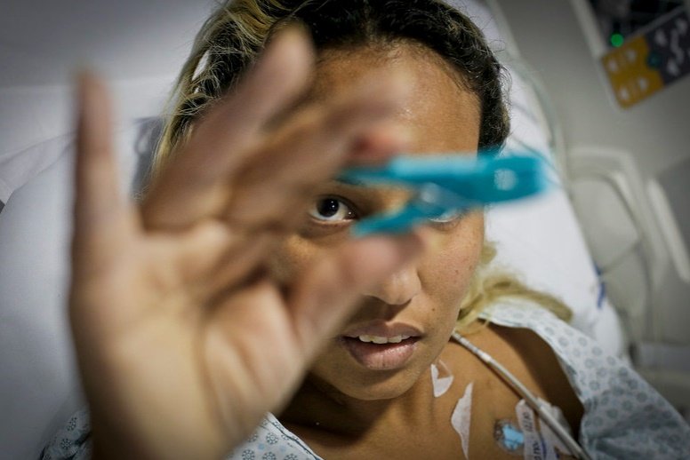 paciente com Covid-19 faz exercícios após ser extubada