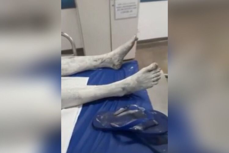 Agressão mulher Goiás tinta
