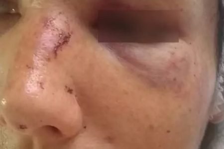 Mulher pede para sogra ficar com filhos e apanha no Tiradentes