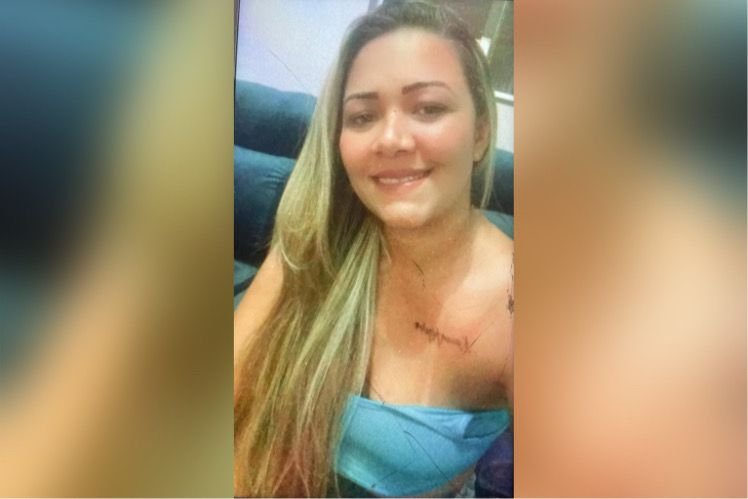 motorista queimado trindade goias