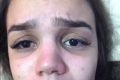 influencer quase perde a visão ao fazer alongamento de cílios