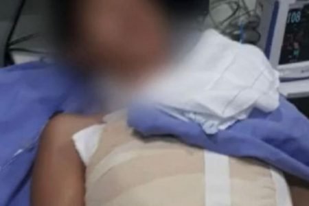 ﻿ Mulher grávida sofre tentativa de feminicídio e tem corpo queimado em Aracaju