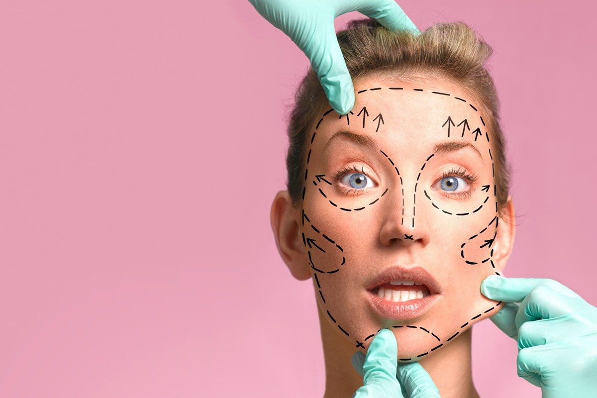 lifting facial cirurgia plástica