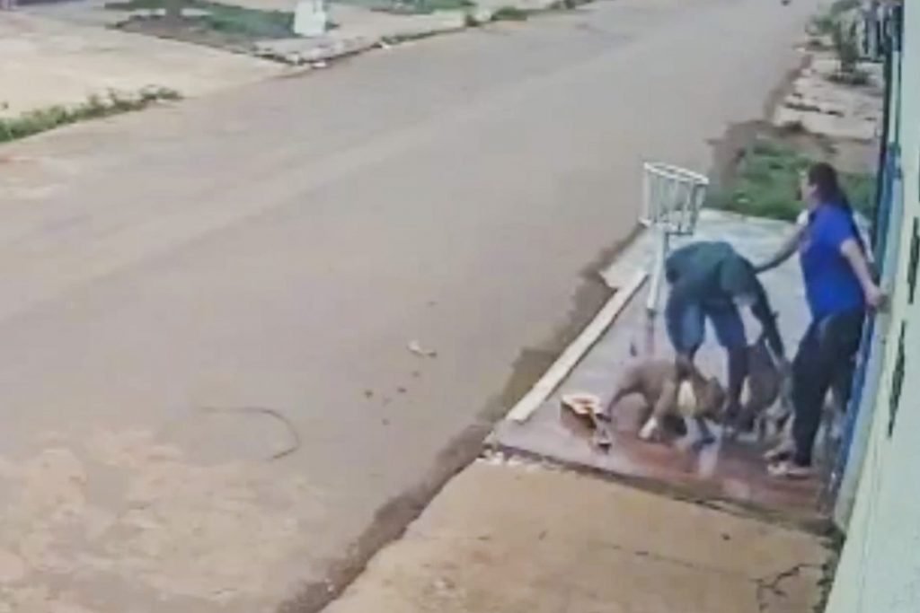 ataque feroz de cachorros deixa mulher com pernas dilaceradas 12