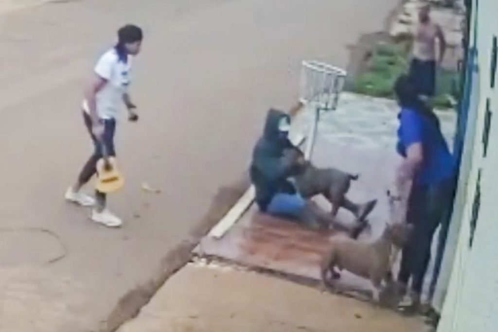 ataque feroz de cachorros deixa mulher com pernas dilaceradas 12
