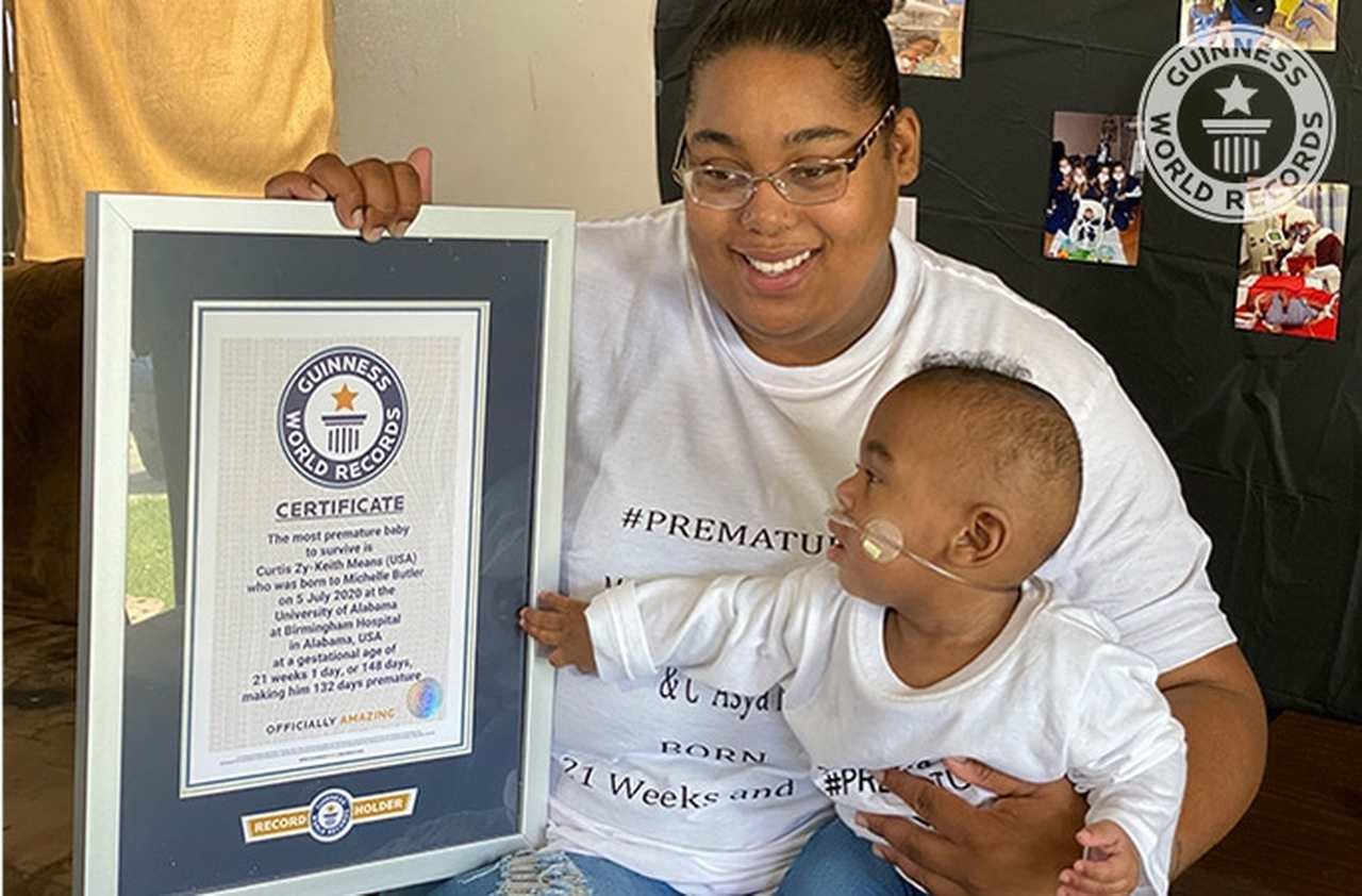 Bebê mais prematuro do mundo entra para o Guinness Book