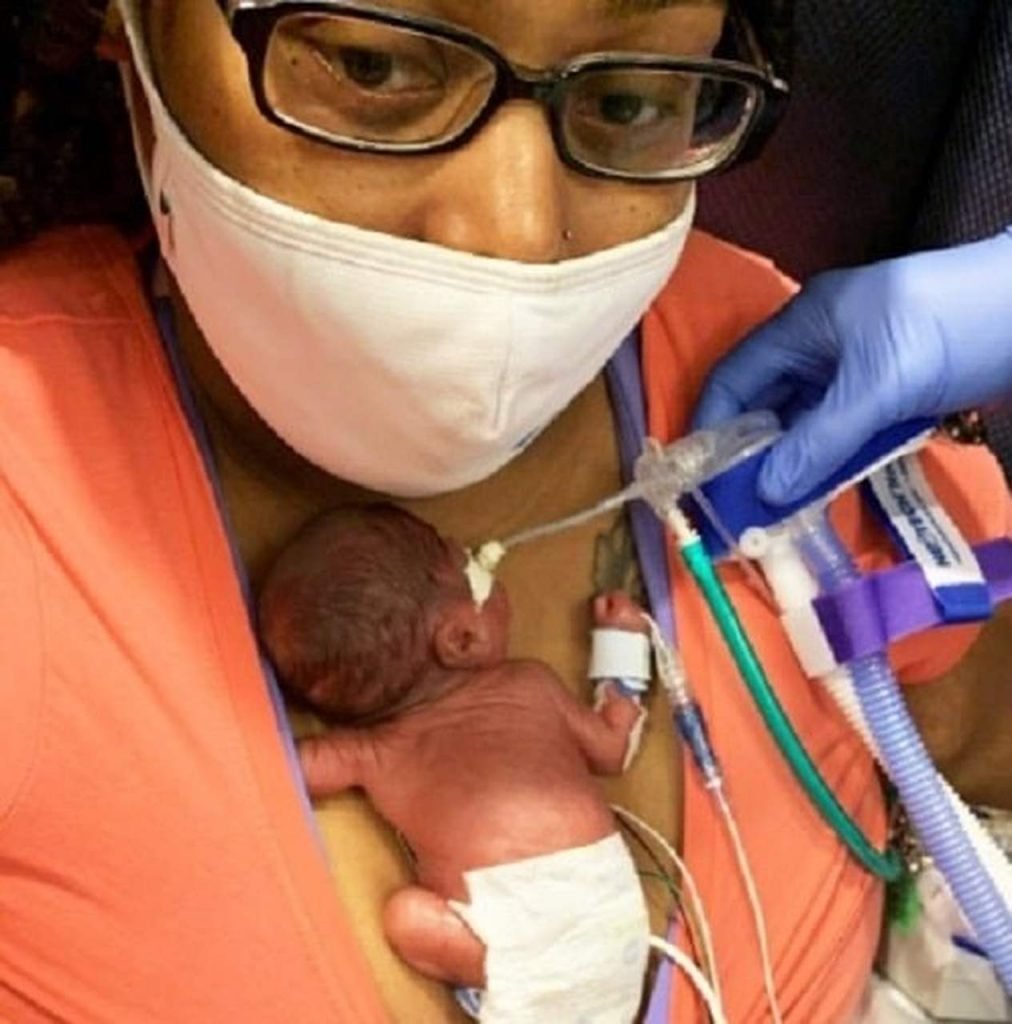 bebe-prematuro-guiness-book