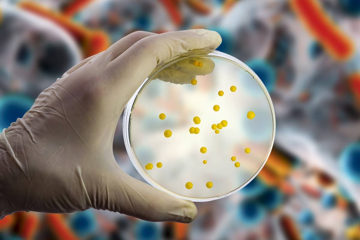 Foto colorida de placa de petri com fungos e bactérias - Metrópoles