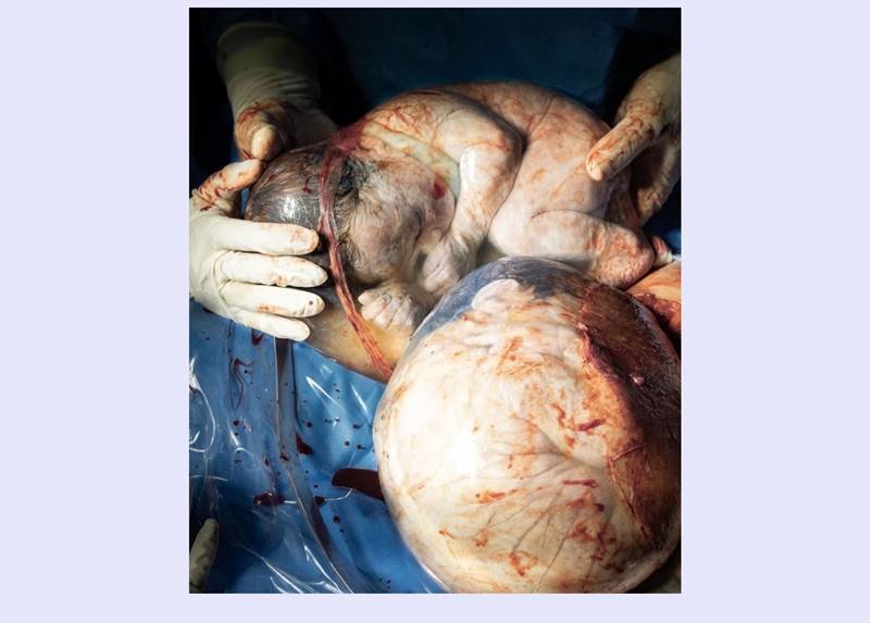 rj gemeos empelicados