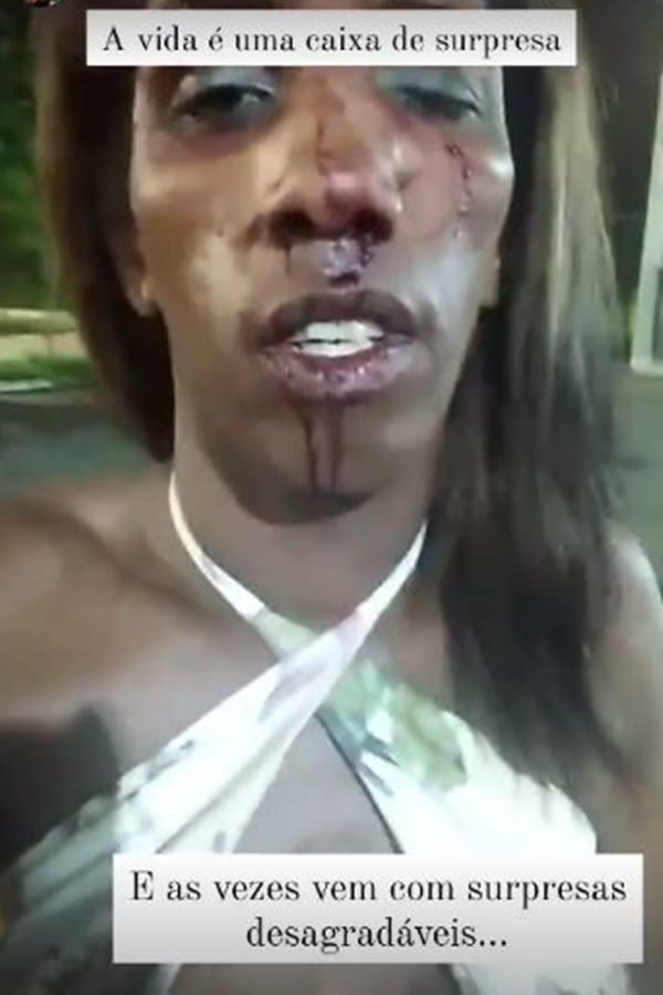 Mulher vítima de agressão