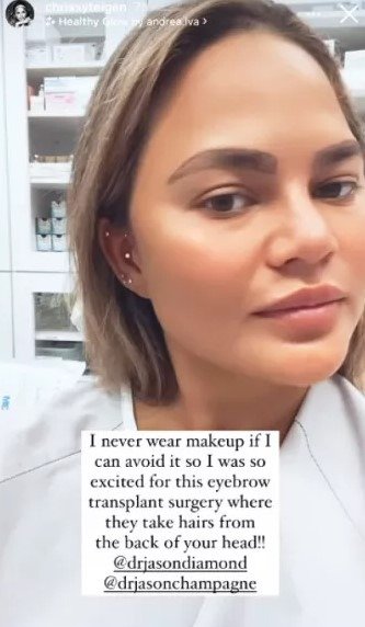 Chrissy Teigen