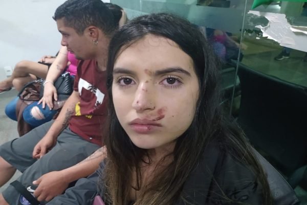 Menina com rosto ensanguentado