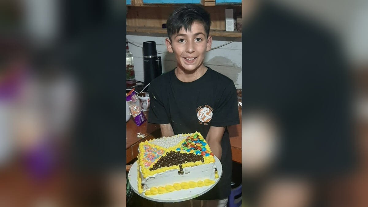 Menino faz bolos decorados para pagar cirurgia após queimaduras