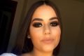 annelise lopes estudante que se queimou em aula de química em anápolis, goiás