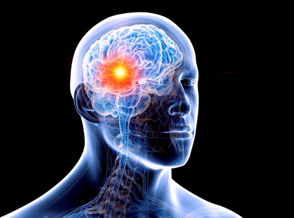 ilustração de tumor no cérebro