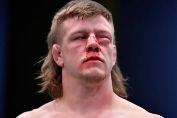 Lutador fica com olho desfigurado após luta