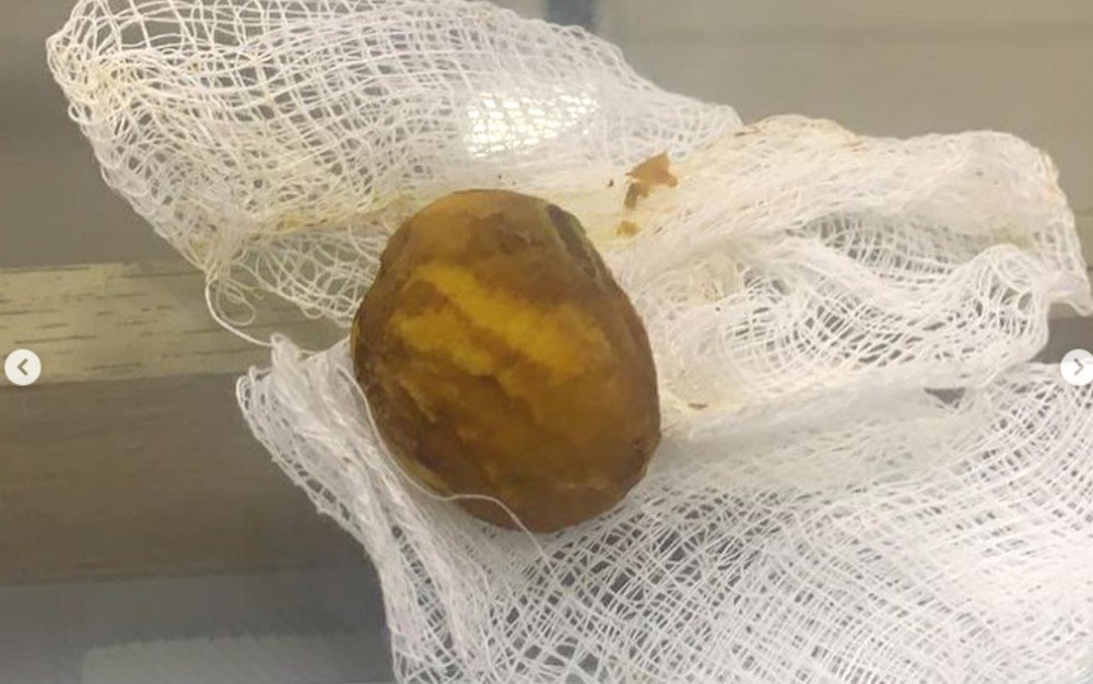 Caroço de pequi que ficou intalado no estômago do cachorro Nick em Goiânia, Goiás