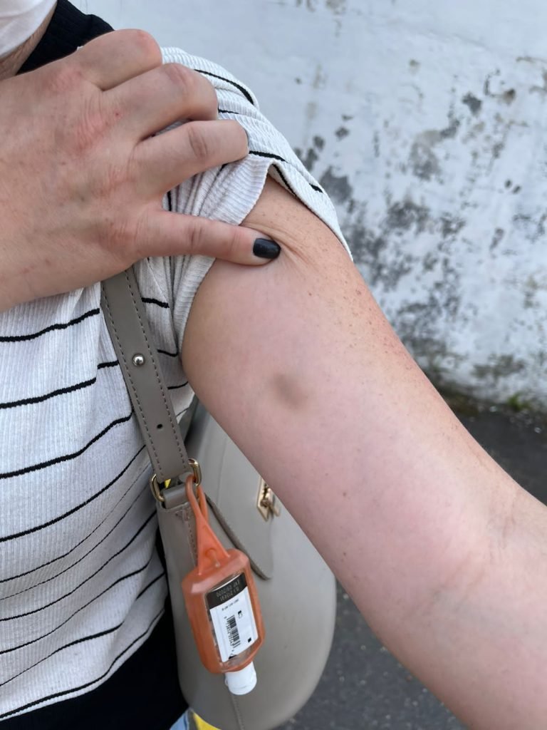 Erica Leoratti, de 44 anos, que foi agredida com socos e cabeçadas vive uma rotina marcada pelo medo e pela indignação