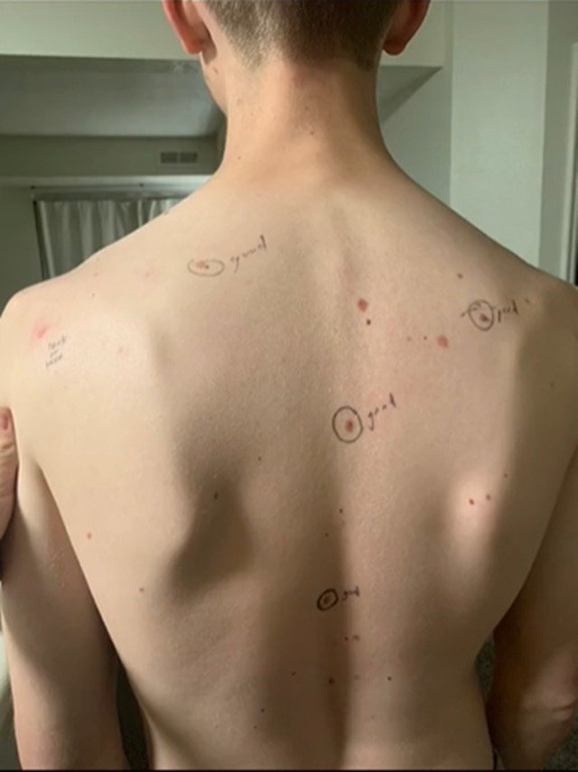 Homem de frente com círculos ao redor de pintas