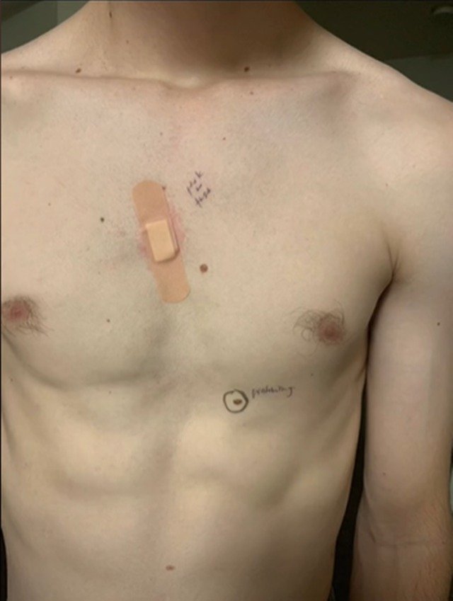 Homem de frente com anotações ao redor dos círcuclos