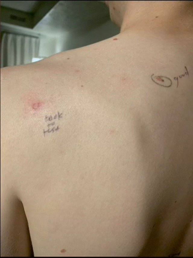 Ombro do homem com anotações de caneta