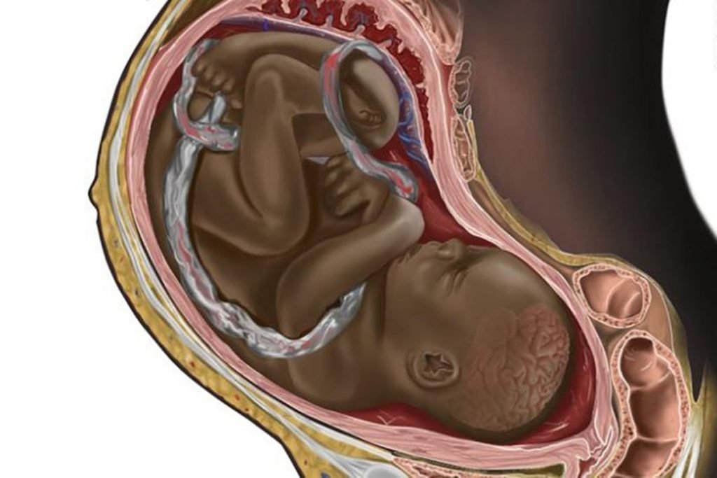 ilustração de um feto negro, em cores