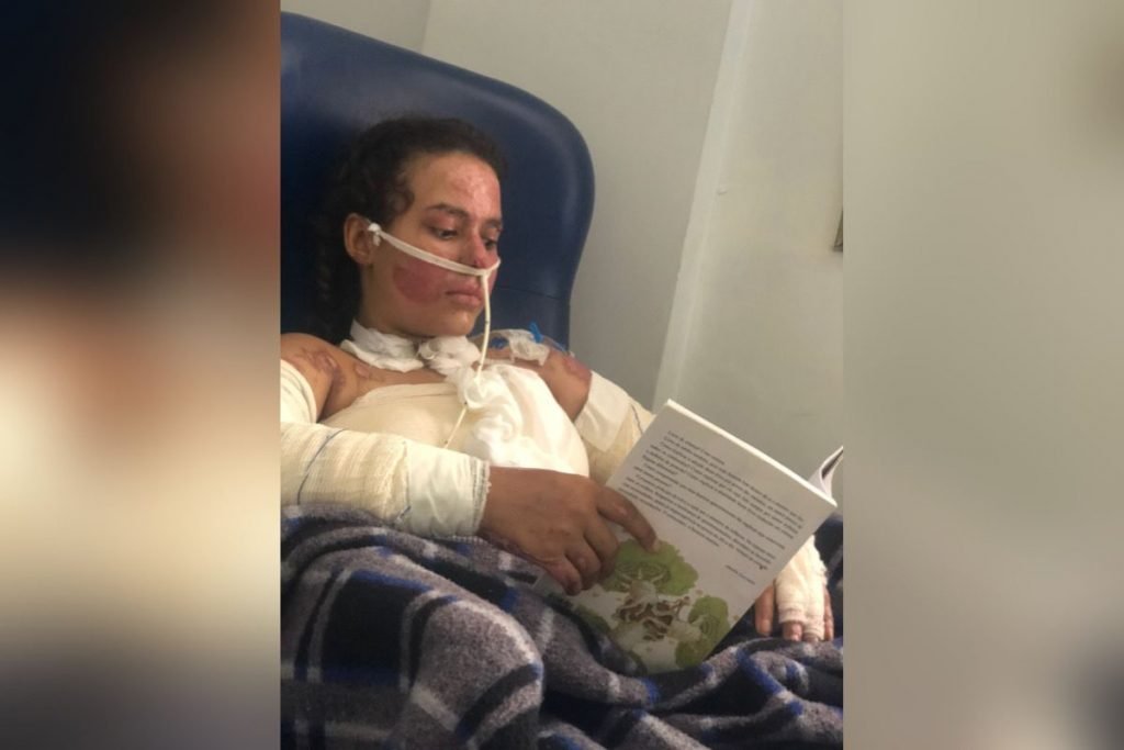 Annelise Queimadura Explosão Escola Anapolis Goias