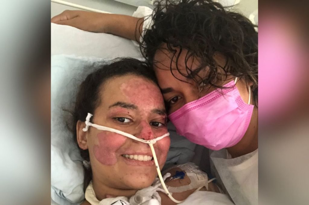 Annelise Queimadura Explosão Escola Anapolis Goias