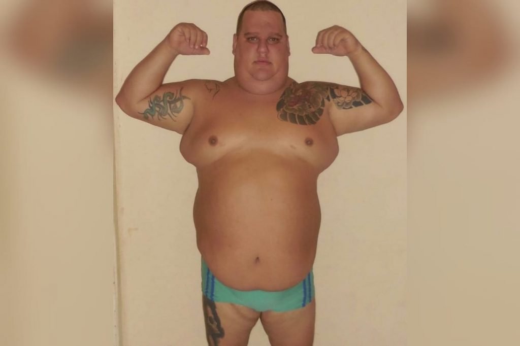 Felippe Ornellas fez cirurgia bariátrica e emagreceu mais de 90 quilos