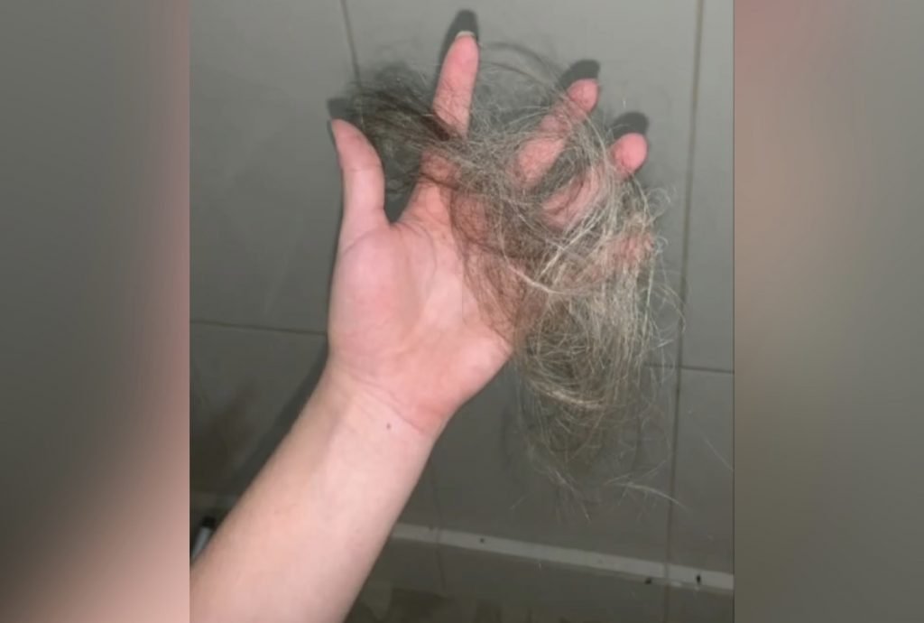 Homem arrancou tufos de cabelo de influencer digital