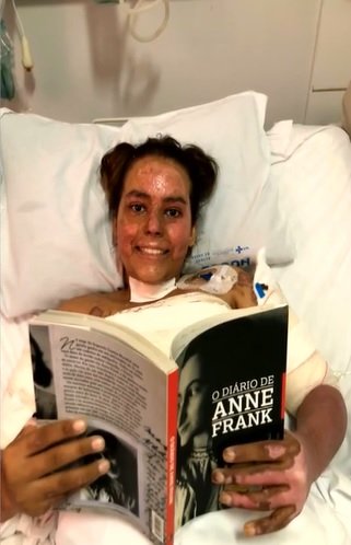 Annelise Lopes de Andrade após cirurgia de enxerto em Goiânia, Goiás
