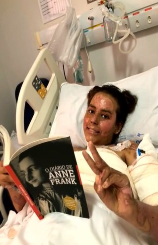 Annelise Lopes de Andrade passa bem após cirurgia de enxerto em Goiânia, Goiás