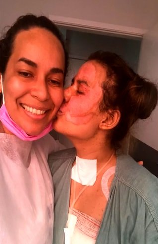 Diolange e a filha, Annelise Lopesa de Andrade, que recebeu enxerto de pele, em Goiânia, Goiás