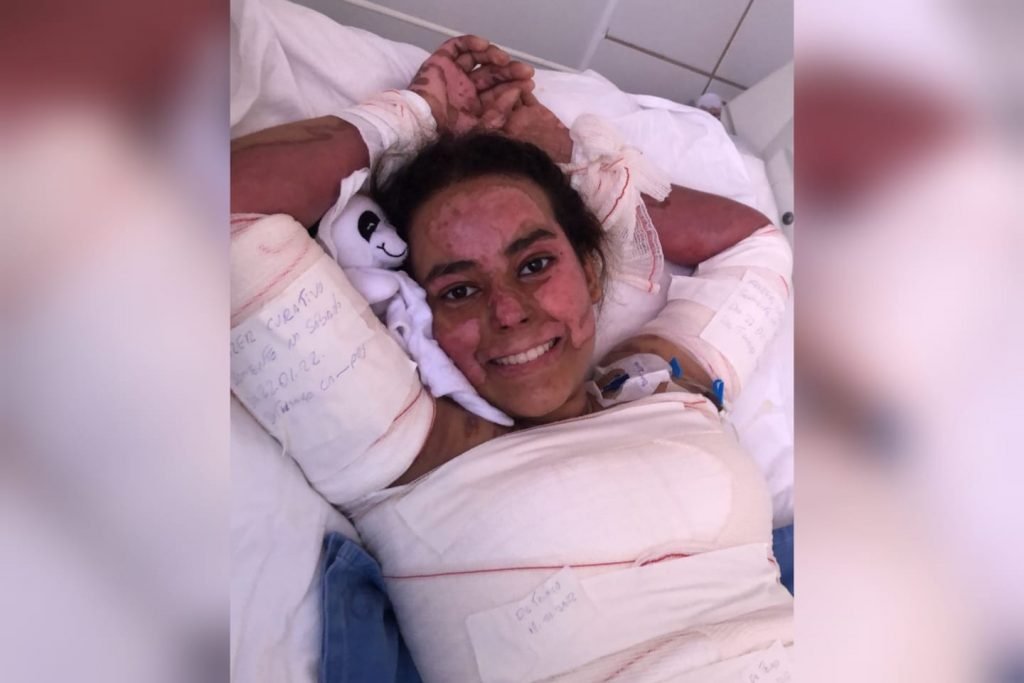 Mãe e filha, estudante que queimou 60% do corpo durante experimento químico na escola em Anápolis, Goiás