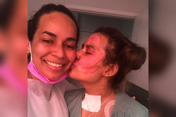 Mãe e filha, estudante que queimou 60% do corpo durante experimento químico na escola em Anápolis, Goiás