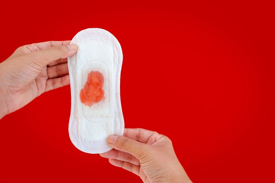 Menstruação com coágulos: 7 principais causas (e o que fazer) - Tua Saúde