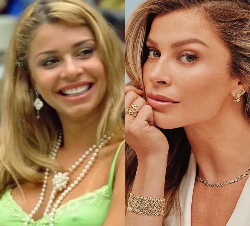 Confira O Antes E O Depois De Ex Participantes Do Big Brother Brasil Metr Poles