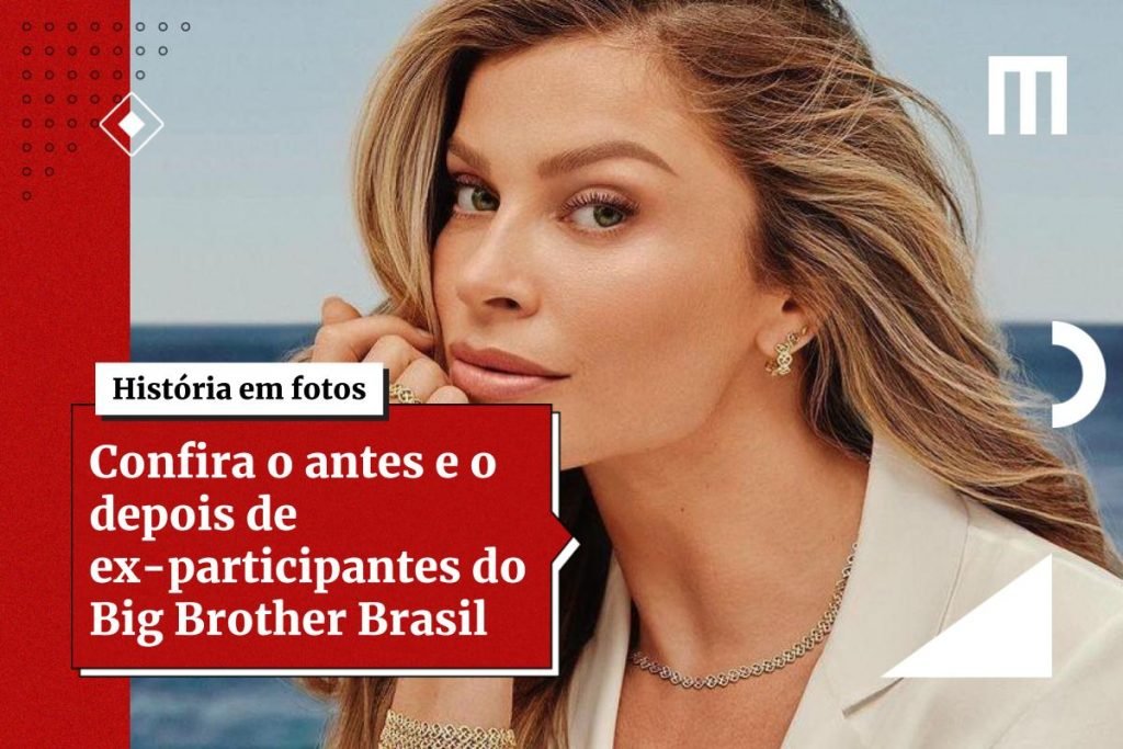 Confira O Antes E O Depois De Ex Participantes Do Big Brother Brasil Metr Poles