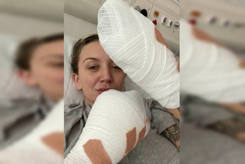 Mulher com mãos enfaixadas