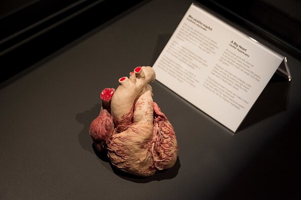 Coração humano plastinado em exibição no Museu de Atenas, na Grécia