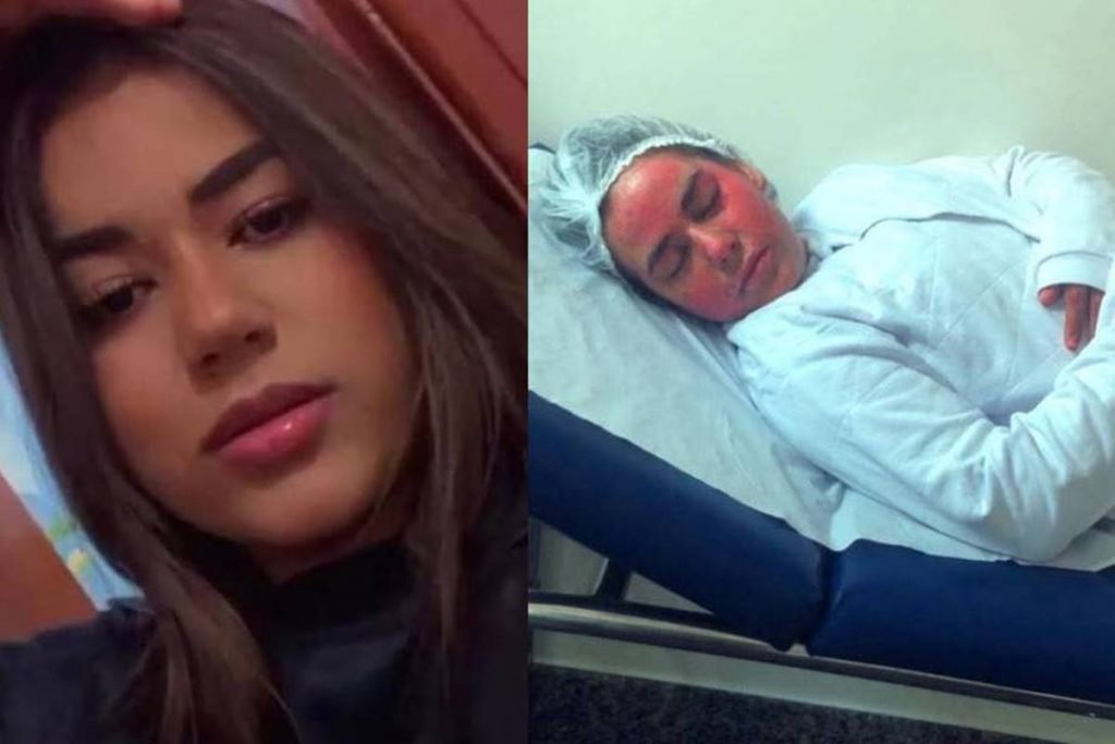 annelise lopes, estudante que se queimou em experimento de química na escola, em goiás