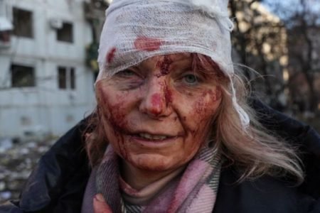 Na fotografia há uma mulher com a cabeça enfaixada e sangue pelo rosto. Ela usa casaco preto e cachecol rosa - Metrópoles